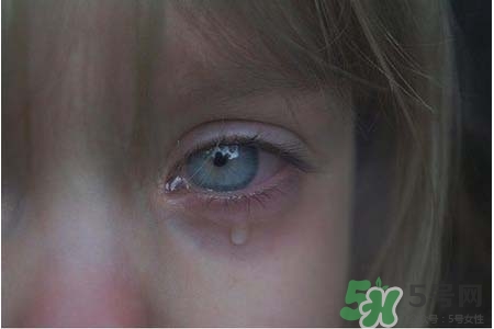 眼睛哭腫了怎么辦？眼睛哭腫了如何快速消腫？