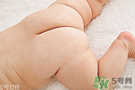 擴(kuò)肛有什么好處？擴(kuò)肛需要注意什么？