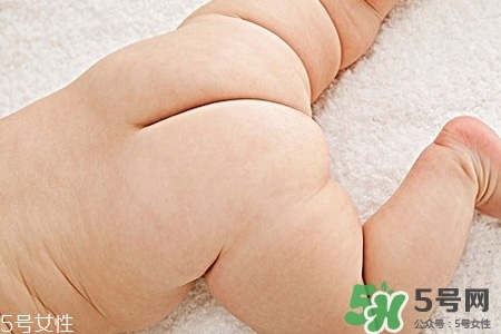 擴(kuò)肛疼嗎？擴(kuò)肛手術(shù)會(huì)很疼嗎？