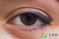 寶寶長針眼了怎么辦?寶寶長針眼怎么好的快