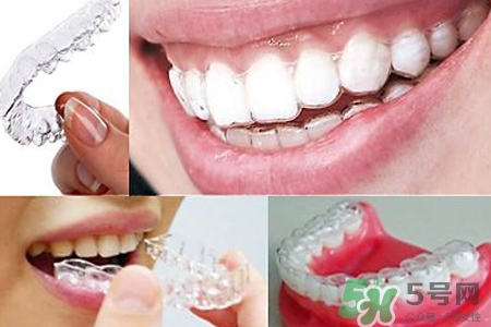 隱形牙套矯正多少錢？隱形牙套多少錢一副？