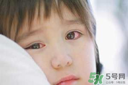 孩子為什么老眨眼睛？孩子總眨眼睛怎么回事？