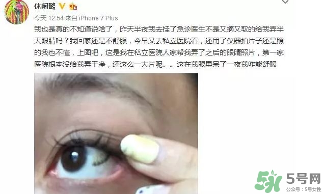 隱形眼鏡會(huì)碎嗎?隱形眼鏡碎在眼睛里怎么辦? 隱形眼鏡會(huì)碎嗎?隱形眼鏡碎在眼睛里怎么辦?