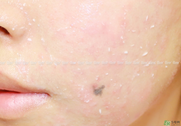 holika懶蛋蛋去角質(zhì)多少錢？holika雞蛋去角質(zhì)啫喱價(jià)格