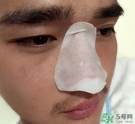 wis去黑頭套裝多少錢?wis去黑頭套裝價(jià)格 wis去黑頭套裝多少錢?wis去黑頭套裝價(jià)格