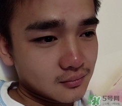 wis去黑頭套裝多少錢?wis去黑頭套裝價(jià)格 wis去黑頭套裝多少錢?wis去黑頭套裝價(jià)格