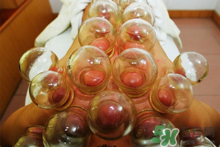 拔罐減肥為什么會反彈？拔罐減肥后不反彈的方法