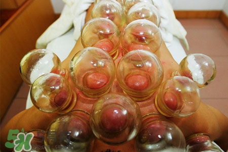 冬天拔罐好嗎？冬季最好不要拔火罐