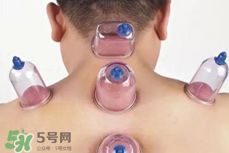 拔罐后可以喝酒嗎？拔罐后多久能喝酒？