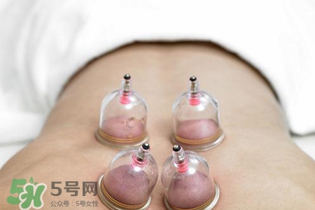 拔罐后可以貼膏藥嗎？拔罐后多久能貼膏藥？