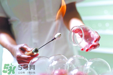 拔罐胃口會變好嗎？拔罐胃口變好怎么回事？