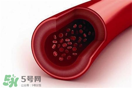 人造血管可以用多久?人造血管的護理 人造血管可以用多久?人造血管的護理