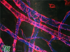 人造血管可以用多久?人造血管的護理 人造血管可以用多久?人造血管的護理