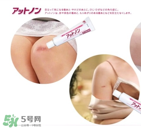 小林制藥去疤膏怎么用？小林制藥去疤膏說明書