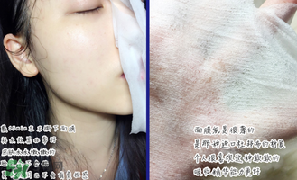 稚優(yōu)泉面膜怎么用？稚優(yōu)泉面膜要洗嗎？