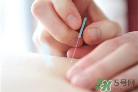 腰間盤突出可以針灸嗎？針灸能治腰間盤突出嗎？