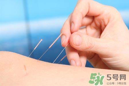 腰間盤突出可以針灸嗎？針灸能治腰間盤突出嗎？