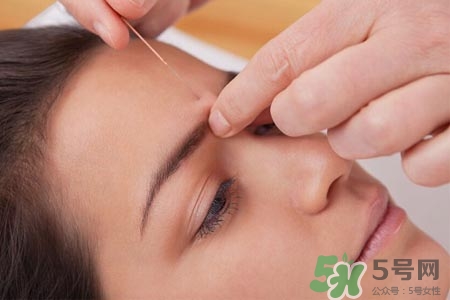 腰間盤突出可以針灸嗎？針灸能治腰間盤突出嗎？