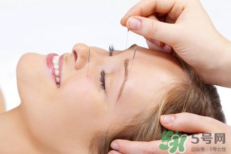 腰間盤突出可以針灸嗎？針灸能治腰間盤突出嗎？