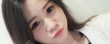 定點雙眼皮能保持多久？定點雙眼皮是永久的嗎？