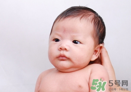 新生兒臉上長小白點(diǎn)是怎么回事?是什么原因?