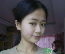 埋線(xiàn)雙眼皮需要拆線(xiàn)嗎？埋線(xiàn)雙眼皮怎么拆線(xiàn)