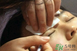 埋線(xiàn)雙眼皮需要拆線(xiàn)嗎？埋線(xiàn)雙眼皮怎么拆線(xiàn)