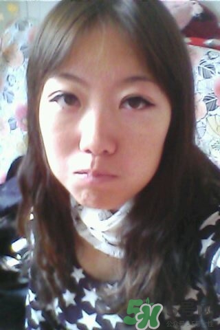 什么是定點雙眼皮？定點雙眼皮多少錢？