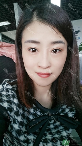 埋線雙眼皮能保持多久？埋線雙眼皮是永久嗎