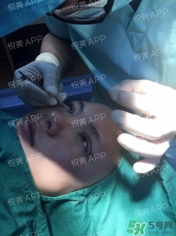 定點(diǎn)雙眼皮恢復(fù)過(guò)程圖_定點(diǎn)雙眼皮要多久恢復(fù)