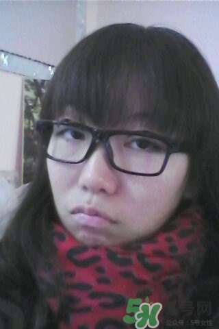 什么是定點雙眼皮？定點雙眼皮多少錢？