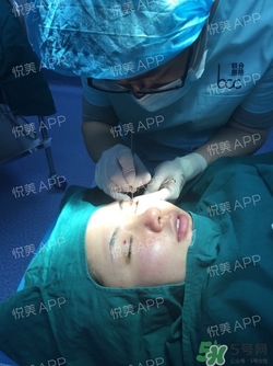 定點(diǎn)雙眼皮恢復(fù)過(guò)程圖_定點(diǎn)雙眼皮要多久恢復(fù)