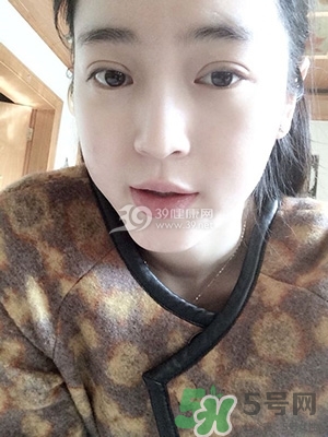 什么是定點雙眼皮？定點雙眼皮多少錢？