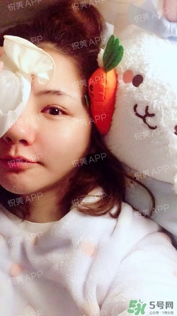 定點(diǎn)雙眼皮恢復(fù)過(guò)程圖_定點(diǎn)雙眼皮要多久恢復(fù)