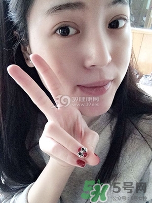 什么是定點雙眼皮？定點雙眼皮多少錢？