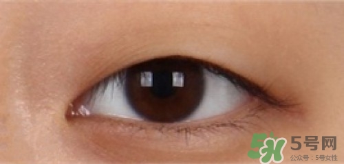 埋線雙眼皮多久恢復(fù)自然？埋線雙眼皮多久能恢復(fù)