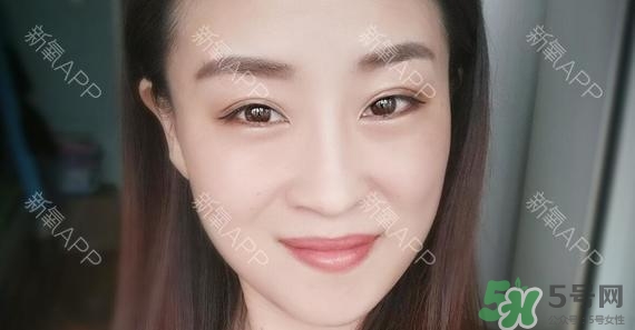 埋線雙眼皮能保持多久？埋線雙眼皮是永久嗎