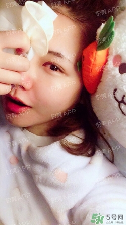 定點(diǎn)雙眼皮恢復(fù)過(guò)程圖_定點(diǎn)雙眼皮要多久恢復(fù)