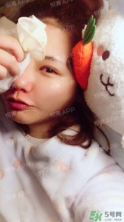 定點(diǎn)雙眼皮恢復(fù)過(guò)程圖_定點(diǎn)雙眼皮要多久恢復(fù)