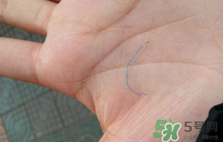 埋線(xiàn)雙眼皮需要拆線(xiàn)嗎？埋線(xiàn)雙眼皮怎么拆線(xiàn)