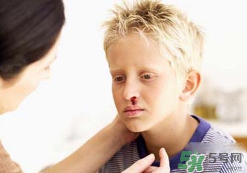 半夜流鼻血是什么原因？半夜流鼻血怎么辦？