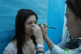 重瞼術(shù)是什么？重瞼術(shù)是永久的嗎？