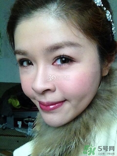 重瞼術(shù)是什么？重瞼術(shù)是永久的嗎？