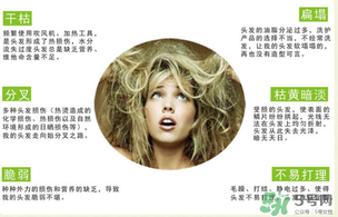 N7發(fā)膜多少錢一盒？N7發(fā)膜價格