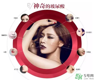 喬雅登是哪個國家的？喬雅登玻尿酸哪個國家？