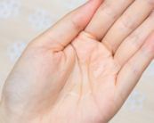 樂(lè)敦cc祛痘印怎么樣？樂(lè)敦cc祛痘印用法