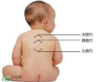 三九貼能治什么病？三九貼的作用