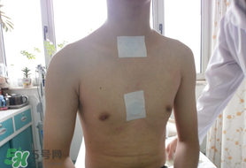 三九貼怎么貼？三九貼的貼法