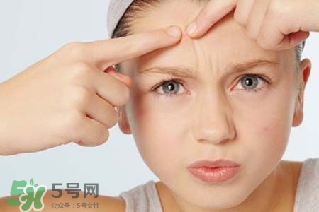 膠原蛋白能祛除痘印嗎？膠原蛋白可以去痘坑嗎？