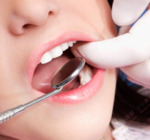 智齒拔完后有個(gè)洞怎么辦？拔智齒后有個(gè)洞多久能長(zhǎng)好？